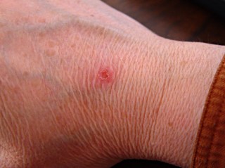 Scorch mark from TOM nozzle