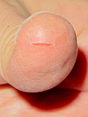 img_1497 - Split thumbprint Split thumbprint