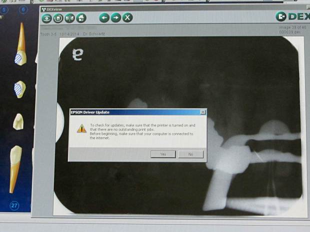 Epson Driver Update - X-Ray Screen