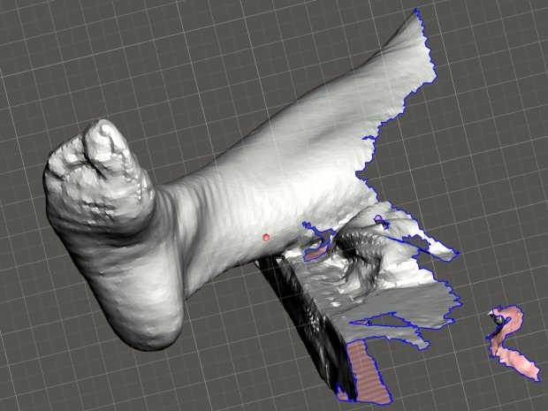 Mary - R foot - complete