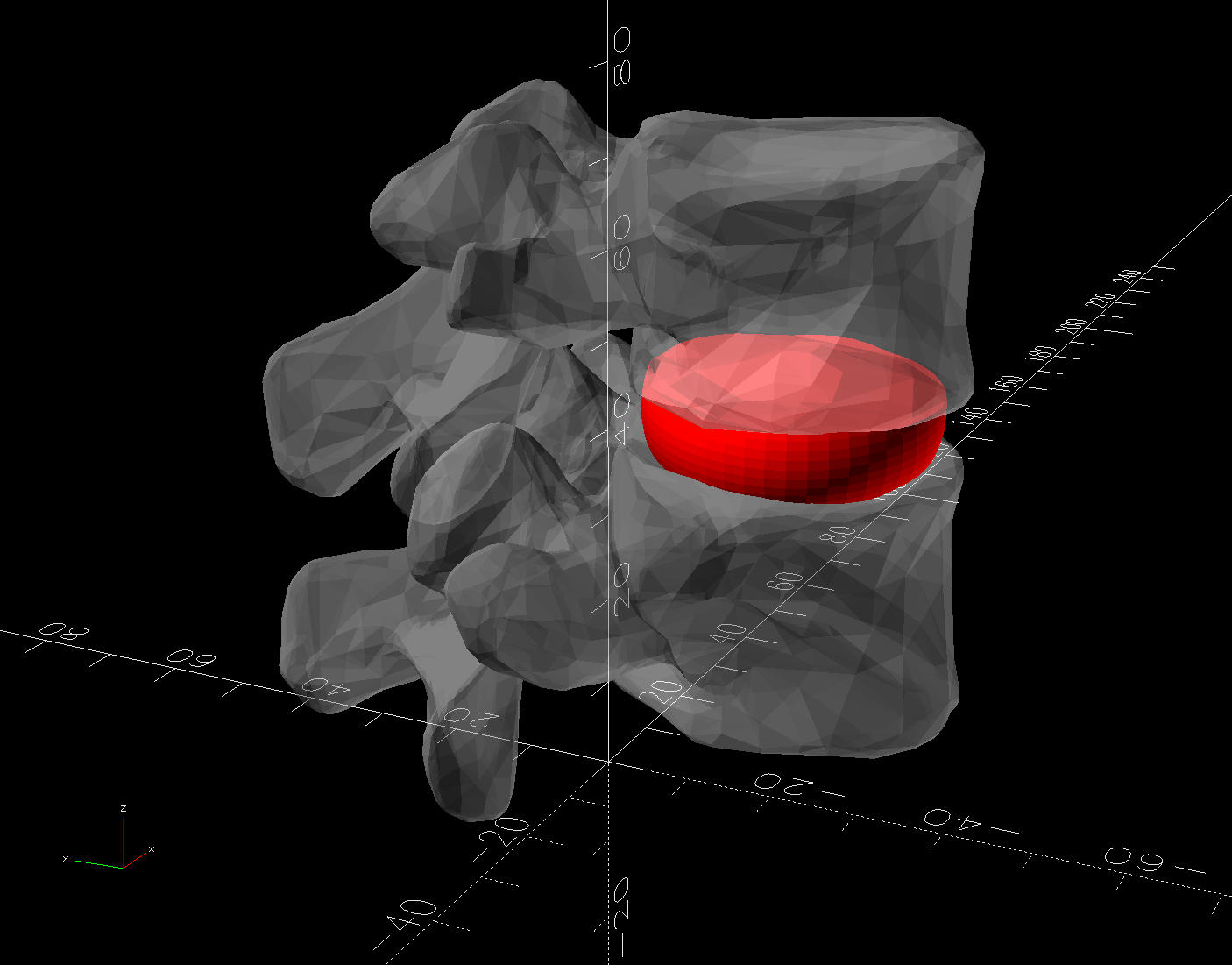 L4 L5 vertebrae disk - solid model