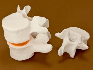 Human Lumbar Vertebrae
